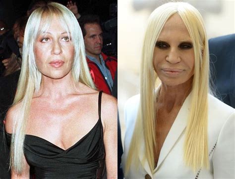 what is donatella versace net worth|Donatella Versace before plastic surgery.